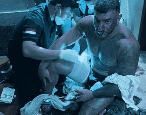 Dua Warga Australia Ditembak di Villa Badung, Satu Tewas